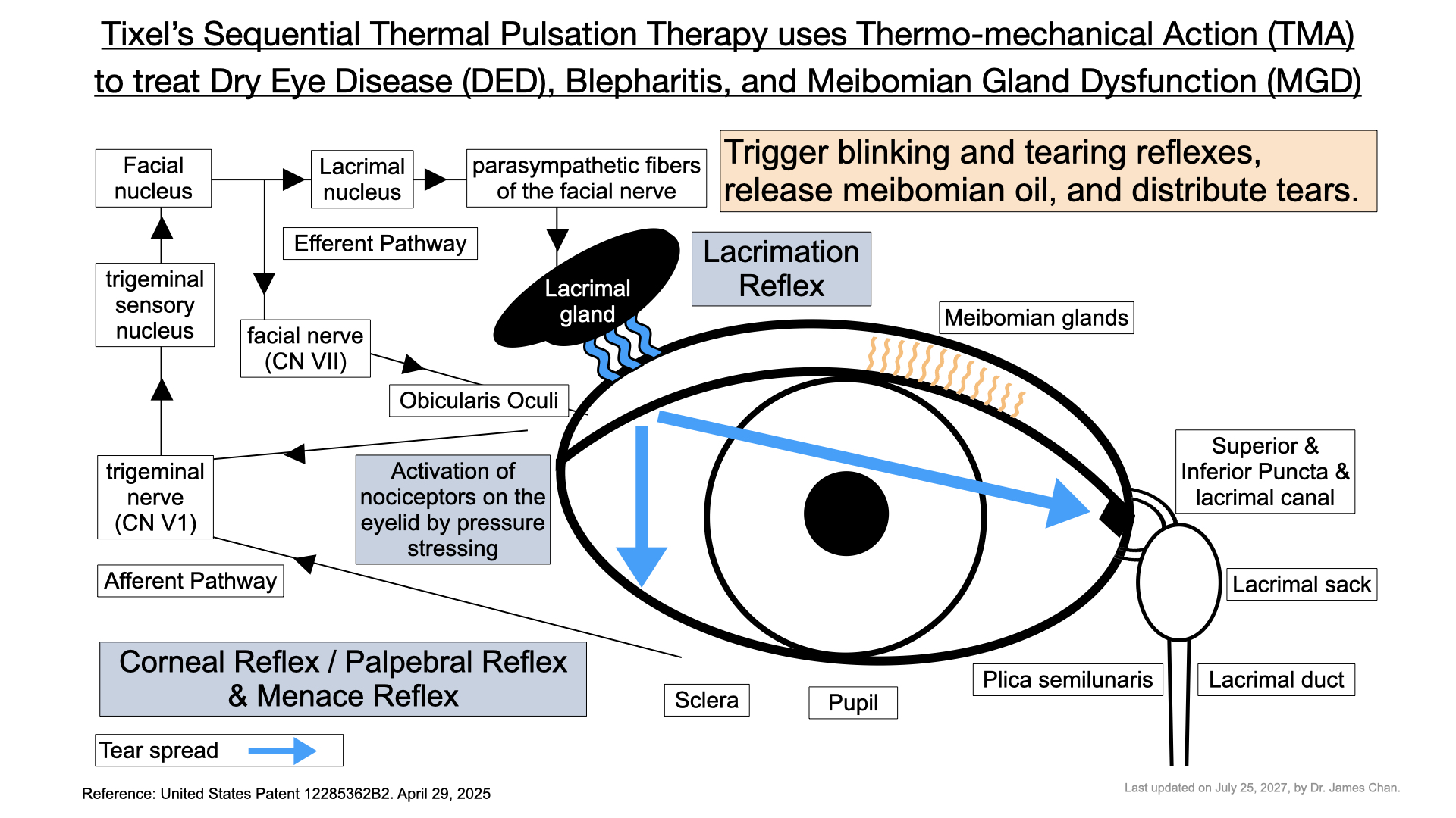 Patented TMA Tixel Sequential Thermal Pulsation Therapy uses Thermo-mechanical Action to treat Dry Eye Disease (DED)_Blepharitis_Meibomian Gland Dysfunction MGD dr james chan 20250727.001
