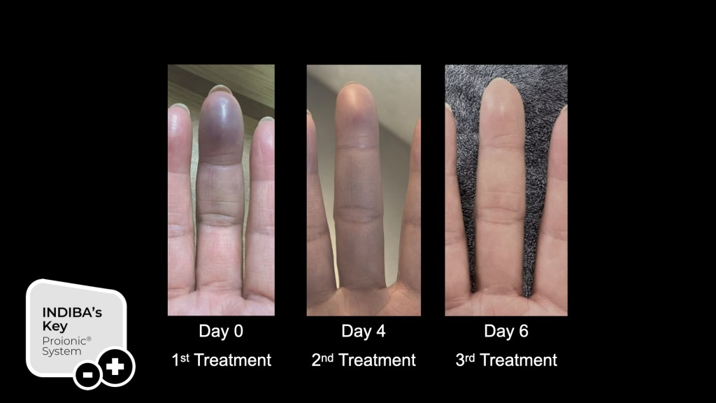 Dr. James Chan Hong Kong-AMSC 2025-INDIBA-TechnologyBasic science 448kHz 20251215 leng.hk.024